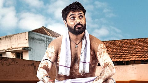 Bilichukki Hallihakki Movie Review: A compelling journey from stigma to self-acceptance