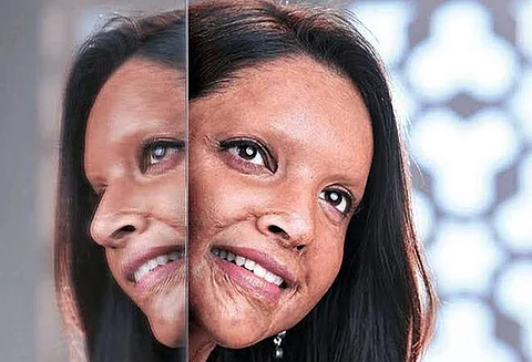 Chhapaak earns Rs. 4.77 crore on Day 1, Tanhaji leads with Rs. 15.10 crore