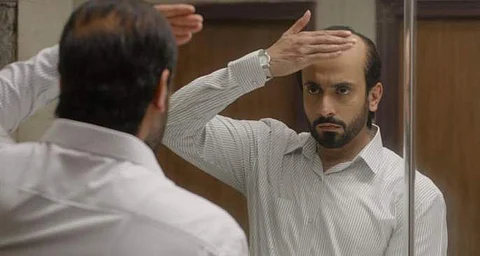 Sunny Singh: Ujda Chapman answers every question a bald person might have