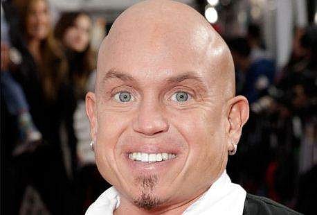 Martin Klebba joins Snow White remake
