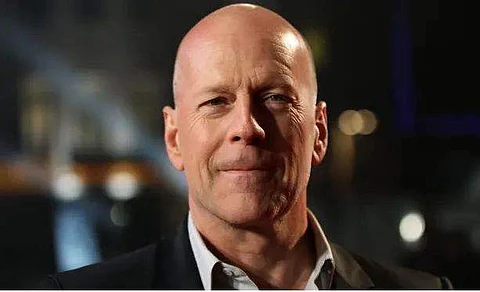 Bruce Willis diagnosed with frontotemporal dementia