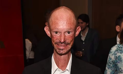 Actor Darren Kent is best known for his role in Game Of Thrones